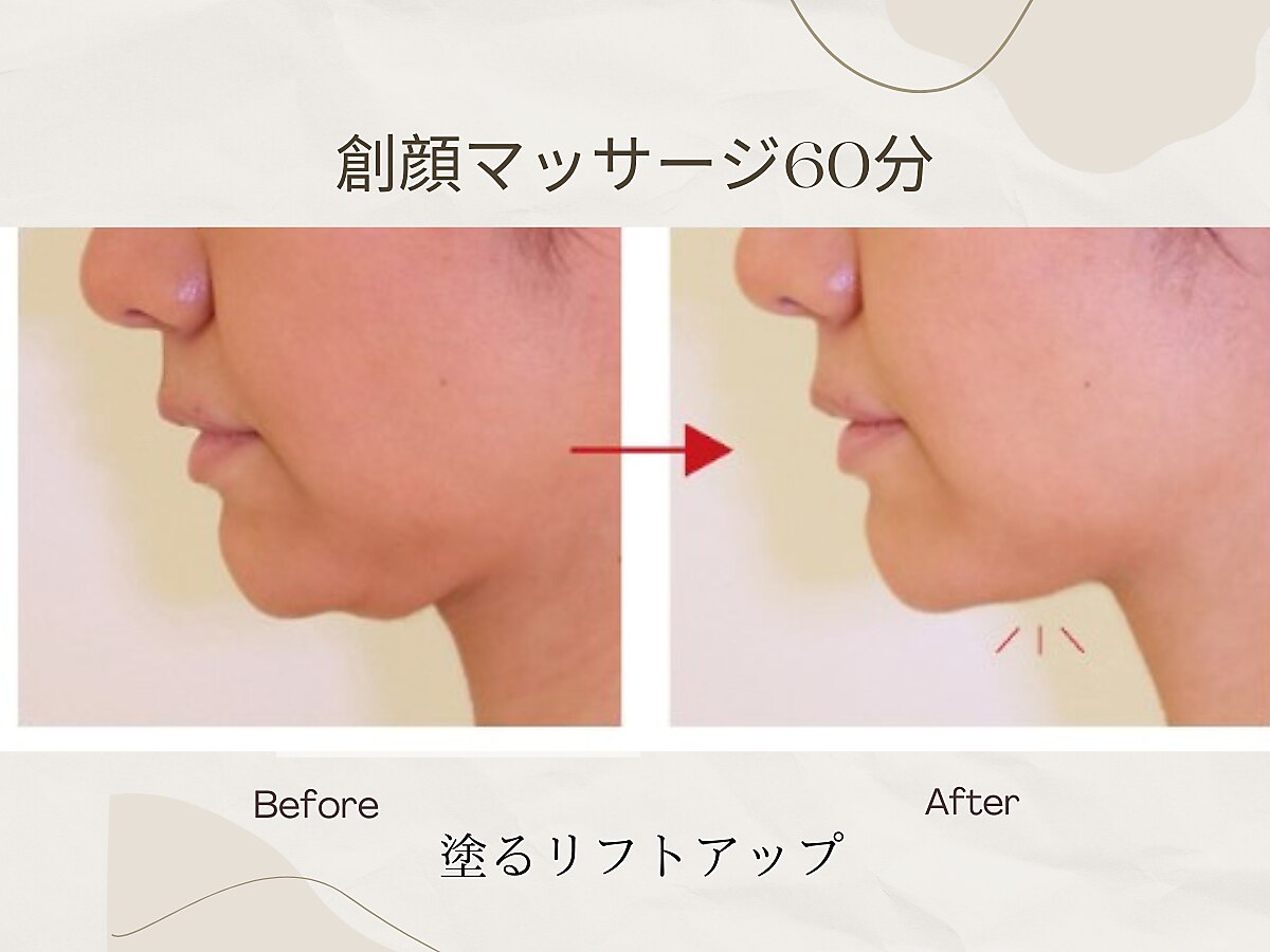 1回で2万円施術 ヒト幹細胞美容エアージェットマシン 1回で2万円施術 ヒト幹細胞美容エアージェットマシン ヒト幹細胞エア