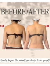 エイエービジュー(Aa.bijou)/30代　女性