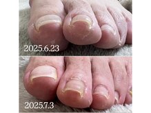 ケア ビューティー ネイル(care beauty NAIL)/