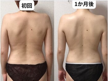 ティーズルーム(T's Room)/痩せたらコリも解消!?