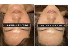 サロン フェリシア(salon Felicia)/40代女性Before/After