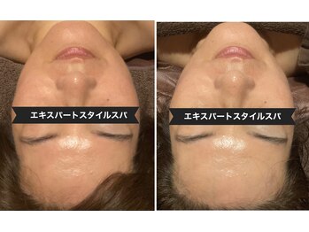 サロン フェリシア(salon Felicia)/40代女性Before/After