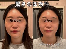 薬手名家 心斎橋店/お客様ビフォーアフター