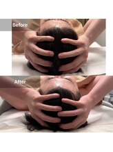 ルネアススパ 南青山(Lune’as Spa)/ドライヘッドスパ