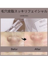 ベルミ―ランド いなげや大和相模大塚/毛穴皮脂スッキリフェイシャル