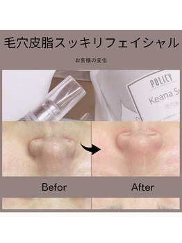 ベルミ―ランド いなげや大和相模大塚/毛穴皮脂スッキリフェイシャル