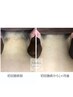 【アップヘアーを綺麗に！後ろ姿美人】　うなじ脱毛・襟足脱毛　￥4,500→