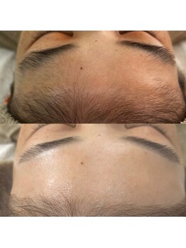 スイ 四条烏丸(SUI)/お顔剃り