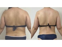 プリマルーチェ/プレミアム上半身プログラム