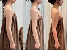 ロココ 豊田店(Rococo)/ビフォーアフター