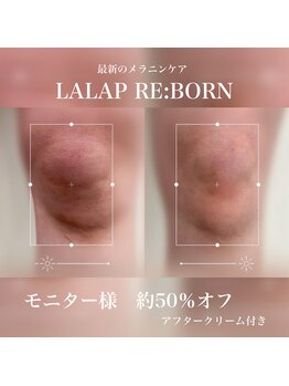 クレビア(CREBIA)/黒ずみを元の色へ♪