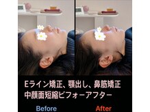 美容矯正サロン レレポノ(LELEPONO)/