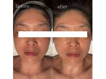 コモレビ(komorebi)の雰囲気（『フェイスワックス』ドライヘッドで疲れ顔もリセット）