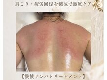 プリア 今治店(Pria)の雰囲気（大人気【肩・背中疲労】 コリを機械でリンパ深層部を集中ケア＊）