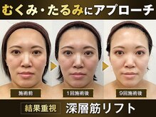 モアビューティー 紙屋町店