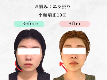 美容整体ウェリナ 中川八田院/小顔矯正/骨盤矯正/痩身整体