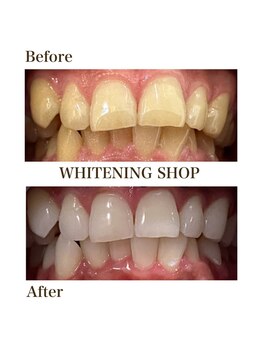 ホワイトニングショップ 四条店/