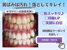 ホワイトニングショップ 多摩店