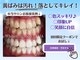 ホワイトニングショップ 多摩店の写真