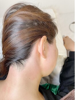 ルピナス(salon de Lupinus)/うなじ脱毛（wax)