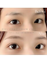 ルーディーアイズ(Loody eyes)/眉毛＆まつ毛ケアが大人気