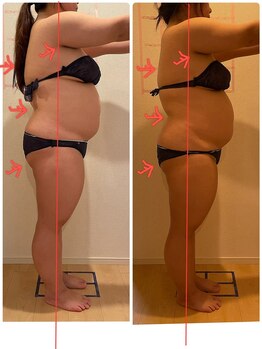 ヨサパーク エスポワール 三木店(YOSAPARK Espoir)/劇的変身くびれコース一回