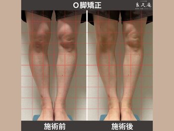 ととのえ処 良久庵/O脚矯正