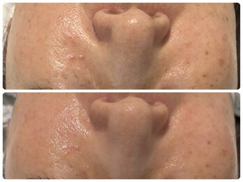 エフェクト 塚口店(effect)/Before After 40代/2回目