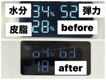 リベル(ReBelle.)/３段階の肌チェック