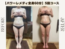 ルカ 北堀江(Luca)/筋膜リリース痩身