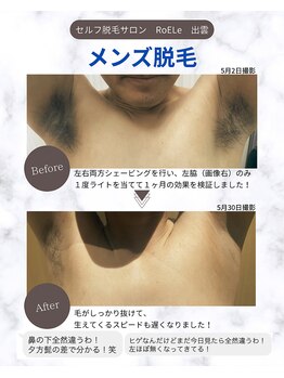 ロエル 出雲(RoELe)の写真/【清潔感UP！】圧倒的なコスパ♪全身脱毛から気になる箇所のみなど希望に合わせて通えるメンズにもオススメ