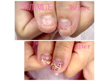 ヒロネイル(Hiro Nail)