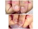 ヒロネイル(Hiro Nail)の写真