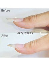 ネイルサロン アニーアンドジーノ シド(NAIL SALON Annie&Gino shido)/爪の悩み