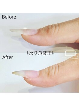ネイルサロン アニーアンドジーノ シド(NAIL SALON Annie&Gino shido)/爪の悩み