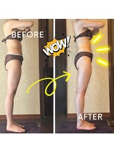 アーユルヴェーダアンドアロマエステ アユス(AYUS)/【３０代】痩身１回施術前後