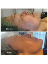 エワル 半田店(ewalu)/お客様BeforeAfter