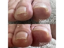 ケア ビューティー ネイル(care beauty NAIL)/