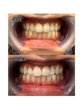 アデル 久留米(ADEL)/ホワイトニング(歯医者提携)