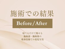 ザ モアナテラス(THE MOANA TERRACE)/施術での結果