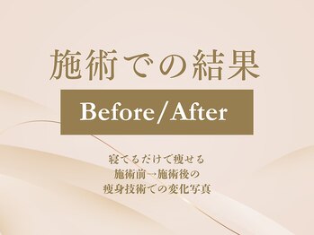 ザ モアナテラス(THE MOANA TERRACE)/施術での結果