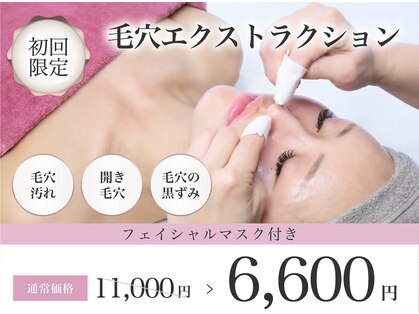 クロス(Xcross)の写真