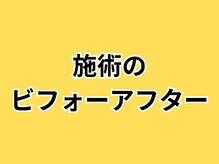 ほねつぎ長嶺鍼灸接骨院/