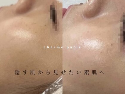 シャルムパリス(charme paris)の写真