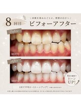 ホワイト 上乃木南店(WHITE)/8回目ビフォーアフター
