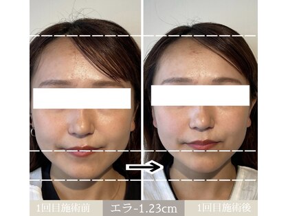 ユウサク(Yusaku)の写真