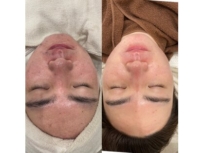 ラルーナ(La Luna)の写真