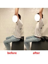 ナオル整体 福岡香椎院(NAORU整体)/40代男性施術事例【肩こり】