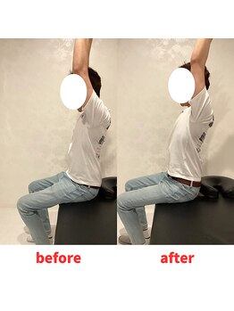 ナオル整体 福岡香椎院(NAORU整体)/40代男性施術事例【肩こり】