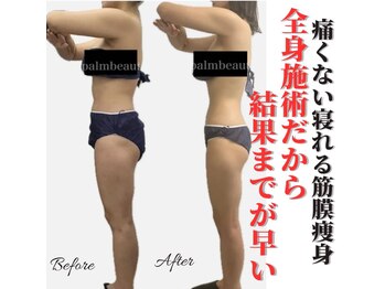 パームボーテ(Palm Beaute)/４ヶ月の変化！痛み少ない3D筋膜
